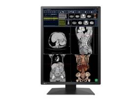 EIZO RADIFORCE 2MP 21.3INCH LCD LED COLOR, INTEGRATED FRONT SENSOR(IFS), 1200X1600, 1000CD/M2, VIEWING ANGLE