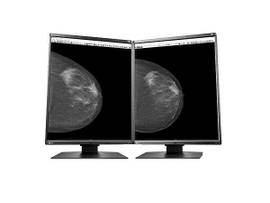 RADIFORCE 5MP MONO DUAL HEAD BUNDLE WITH 2X GX560 DISPLAYS AND 1X NVIDIA QUADRO P2000 VIDEO CARD