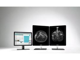 BARCO CORONIS GRAYSCALE 2 HEADS