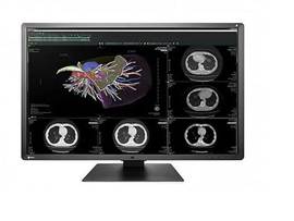 RADIFORCE 6MP COLOR HIGH BRIGHTNESS SINGLE HEAD BUNDLE WITH 1X RX660 DISPLAY AND 1X NVIDIA QUADRO P2000 VIDEO CARD