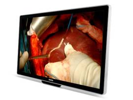 MDSC-8532 SSTP - 32IN LCD MONITOR