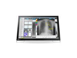 MS-SERIES 23INCH WIDE SCREEN MULTI TOUCH COLOR TFT LCD LED DICOM PRESET BLACK 1920X1080 DISPLAYPORT DVI-D D-SUB INPUT 3YWTY
