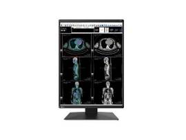 RADIFORCE 3MP 21.3INCH LCD LED COLOR INTEGRATED FRONT SENSOR IFS 1536X2048 DIGITAL INPUT CONTRAST RATIO 1800 1 DUAL LINK DVI DISPLAYPORT1.2 5YWTY