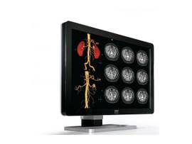 CORONIS 4MP FUSION COLOR NO CARD