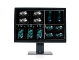 BARCO CORONIS FUSION COLOR 4MP LED SYSTEM INCLUDES 1 2560X1600 COLOR DISPLAY MDCC-4430. NO PROTECTIVE FRONT COVER. QAWEB SOFTWARE(DOWNLOAD)