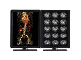 NIO 3MP COLOR LED 1H MXRT-5600