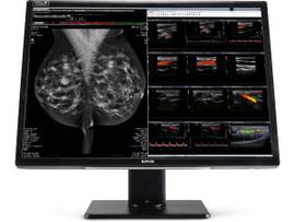BARCO NIO C FUSION 12MP-2H NO DC CARD: 2 MDNC-12130 COLOR DIAGNOSTIC DISPLAYS WITHOUT PROTECTIVE COVER, INCLUDING REQUIRED ACCESS AND US PWR CABLE