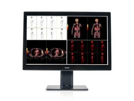 CORONIS 6MP-2H FUSION COLOR NO CARD