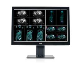 CORONIS 4MP FUSION COLOR MXRT-6700